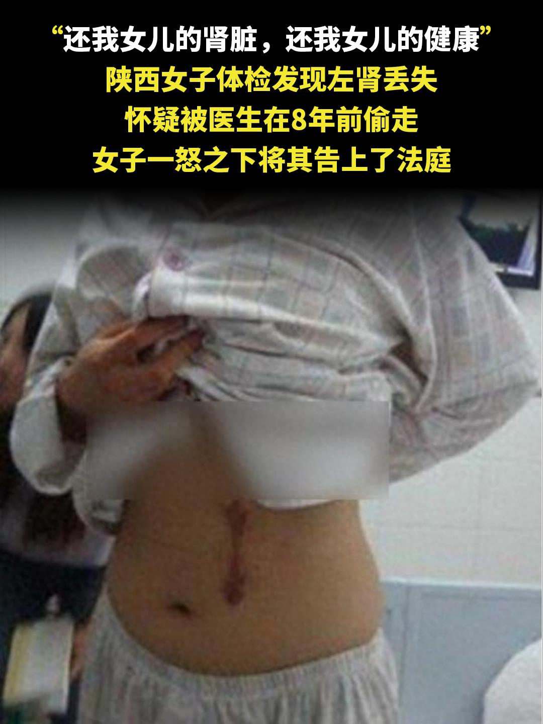 “还我女儿的肾脏，还我女儿的健康” 陕西女子体检发现左肾丢失 怀疑被医...