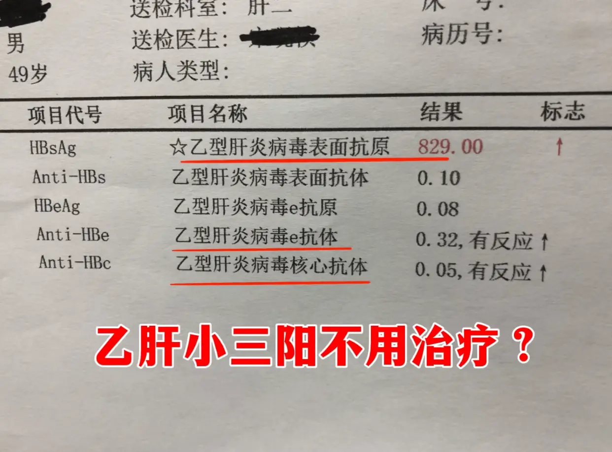 门诊上遇到山东淄博的一位患者，小三阳十几年，一直没治疗，听别人说不用治...