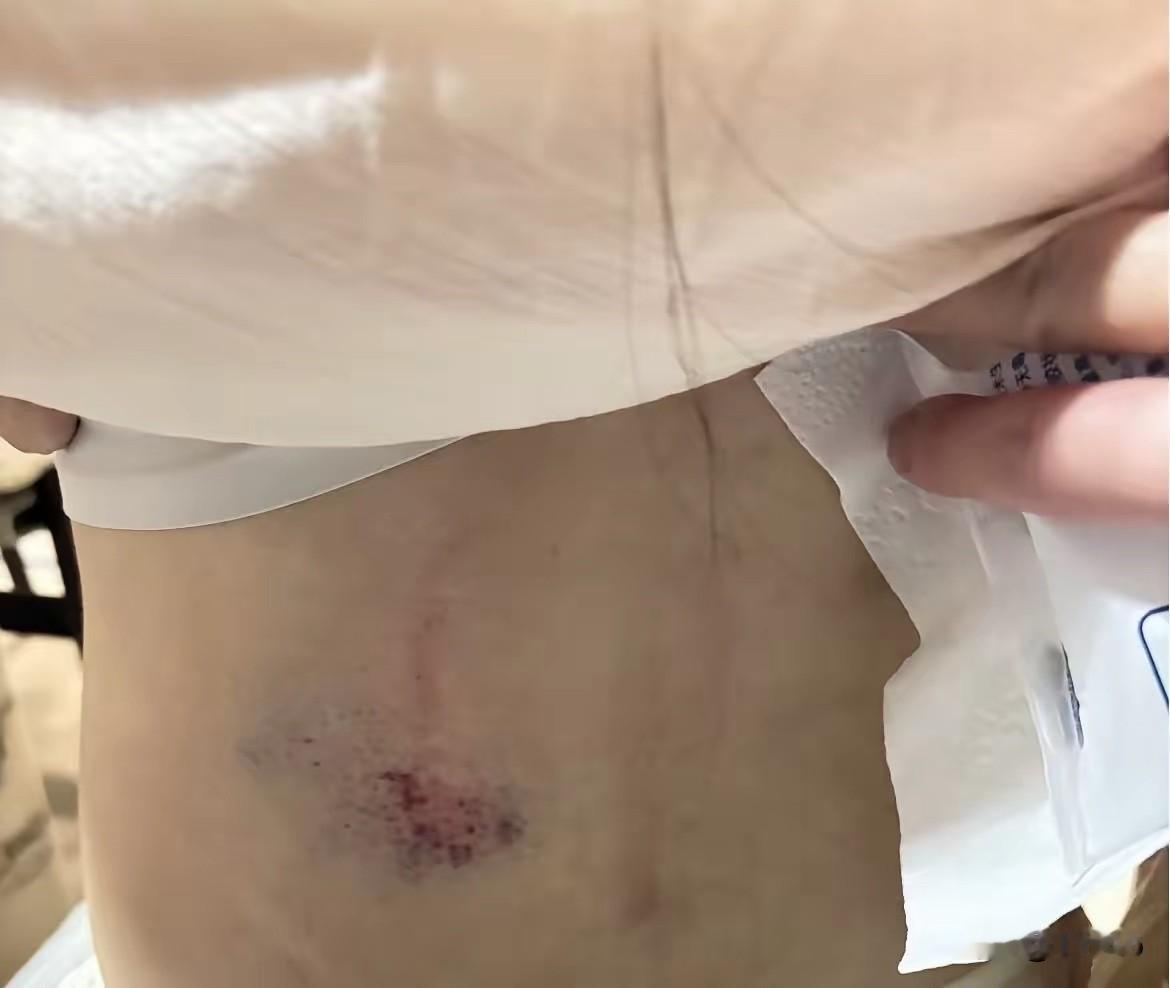 惊险！孕26周露营被小孩沙滩车撞倒落水，孕期出门一定要多留心

国庆假期，一位怀