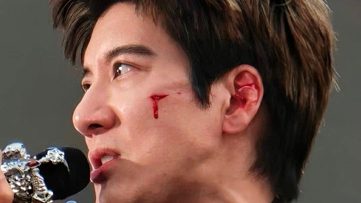王力宏缝了39针【看图片都吓人！满脸缝三十多针还硬撑完三小时，如果是脖子该怎么办
