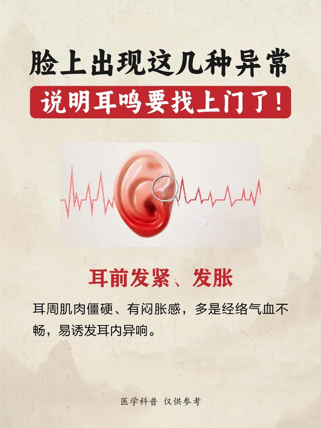 面部出现这几种异常，或许是耳鸣即将到来的预警