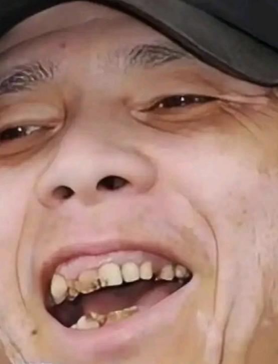 你说冯小刚有那么多钱，为什么一口烂牙不去治治？难道他是故意留在那里磕碜自己的吗？
