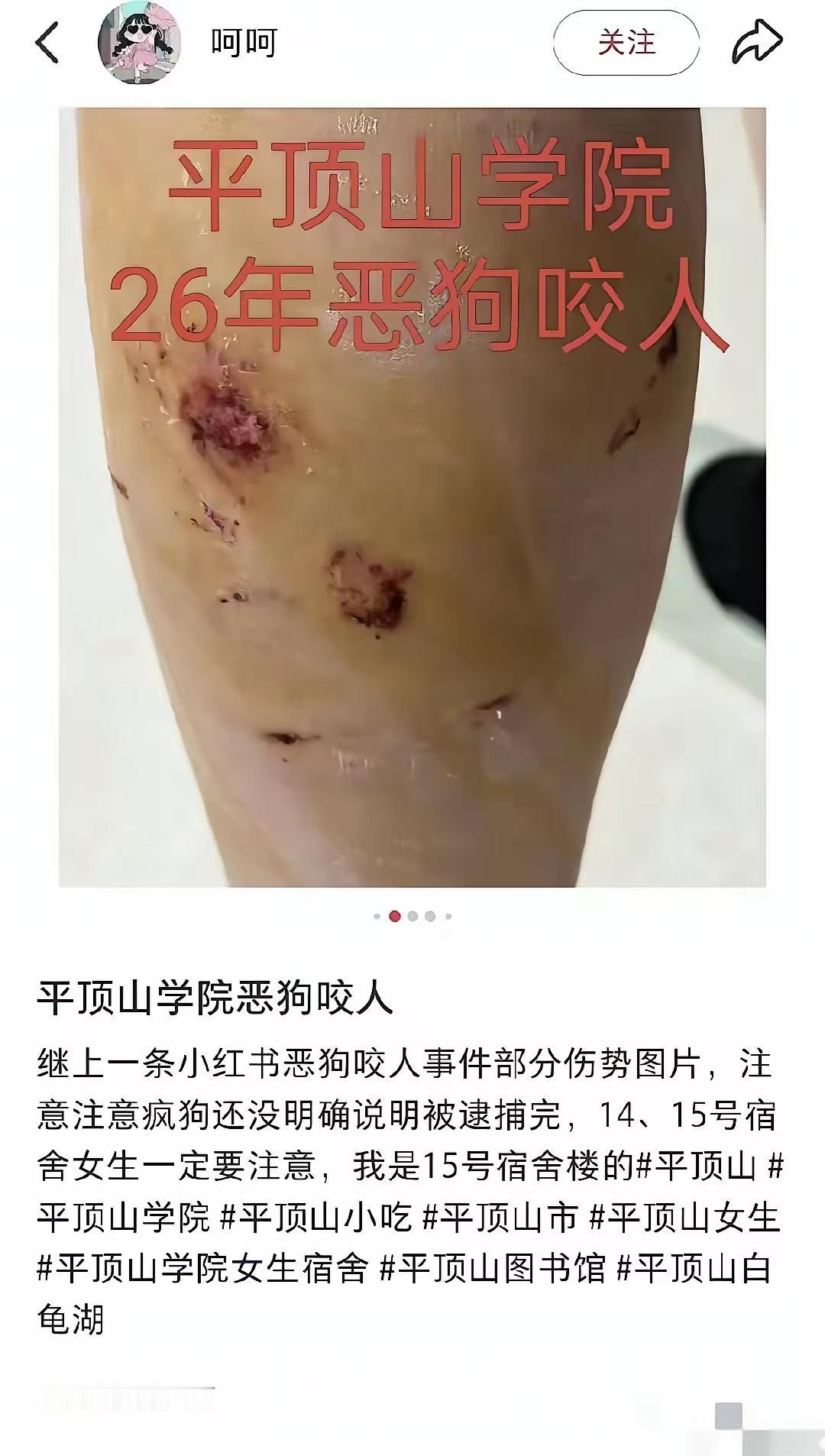 这个大三的学生两年前正好参与了网暴保安的活动，什么你当初也没网暴保安？那保安怎么