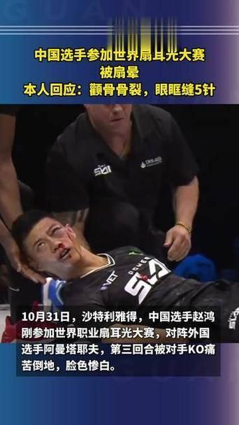 扇耳光大赛意义何在？
中国选手赵鸿刚参加世界扇耳光大赛，最终败给对手阿曼塔耶夫。