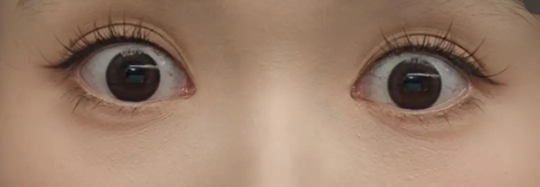 又发现活动综艺演戏都喜欢离不开美瞳的一个人 