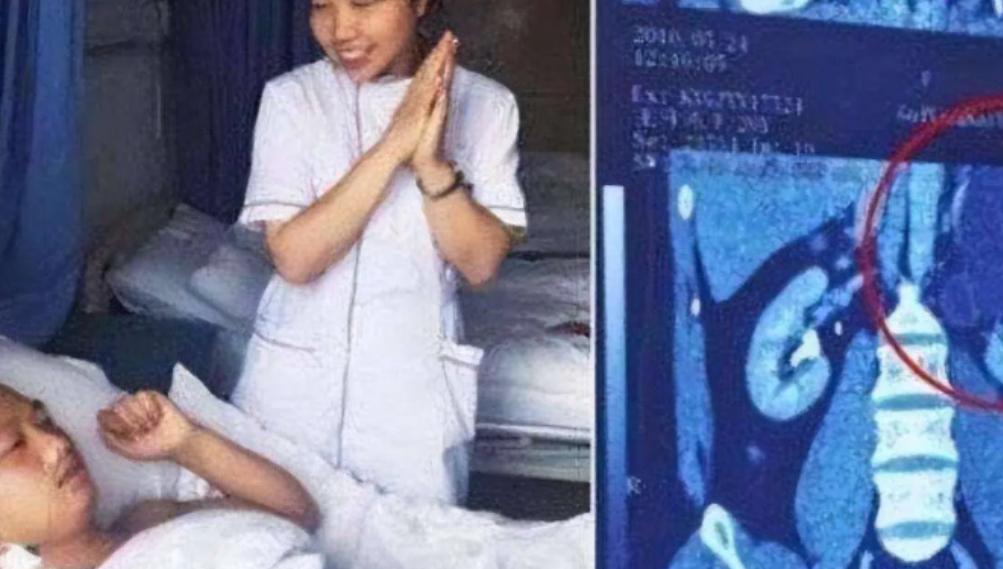 “我的丈夫有4个肾！”2016年，贵州一男子天生神力，可以把白酒当水喝，除此之外