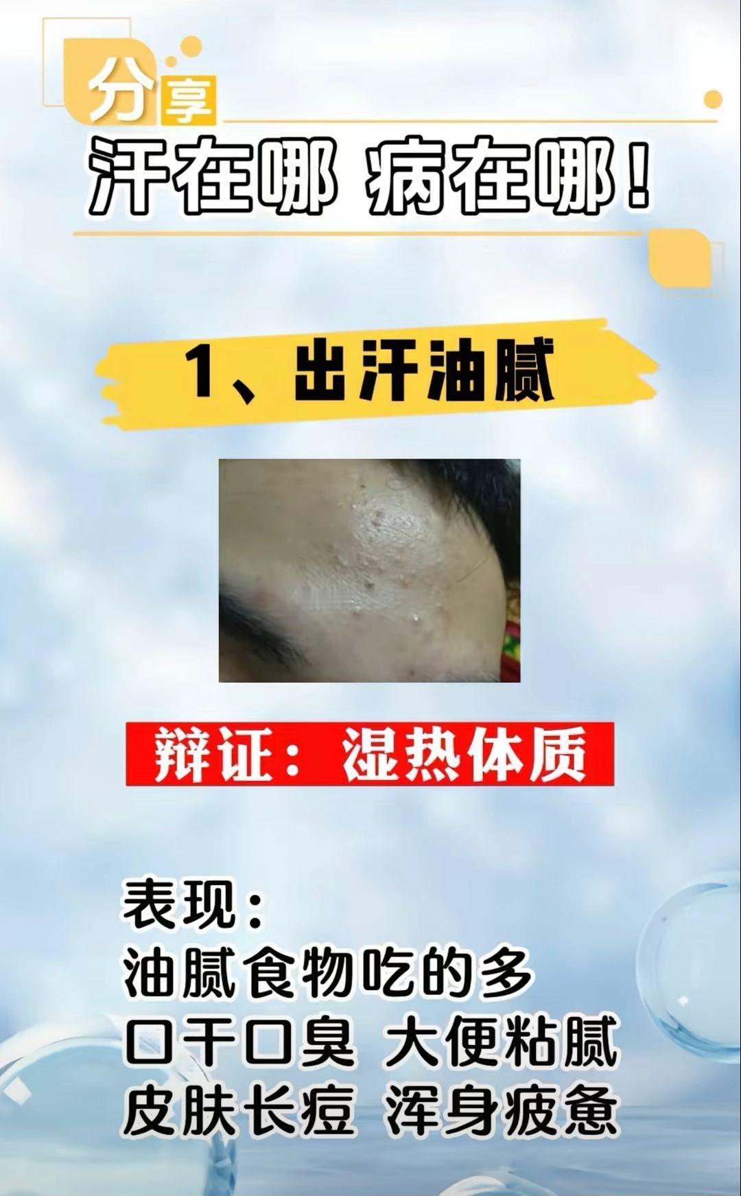 汗在哪 病就在哪