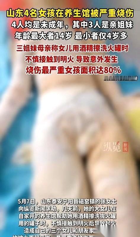 “妈，我帮你。”
山东泰安，14岁的女儿拿起桌上的酒精瓶，想替妈妈擦一下那个拔火