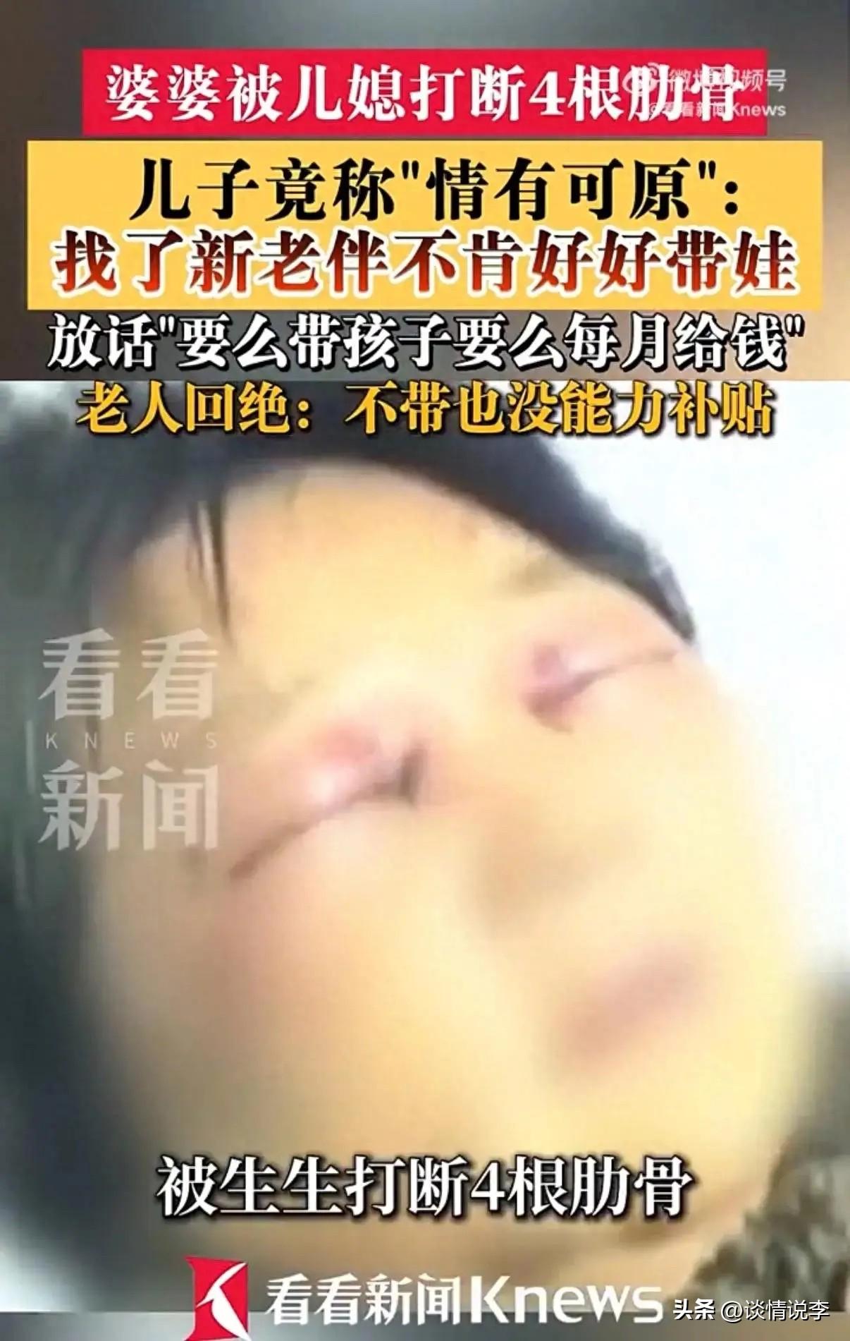 真的是耸人听闻！

浙江嘉兴一儿媳妇，因为婆婆不给自己带娃，竟然硬生生打断了婆婆