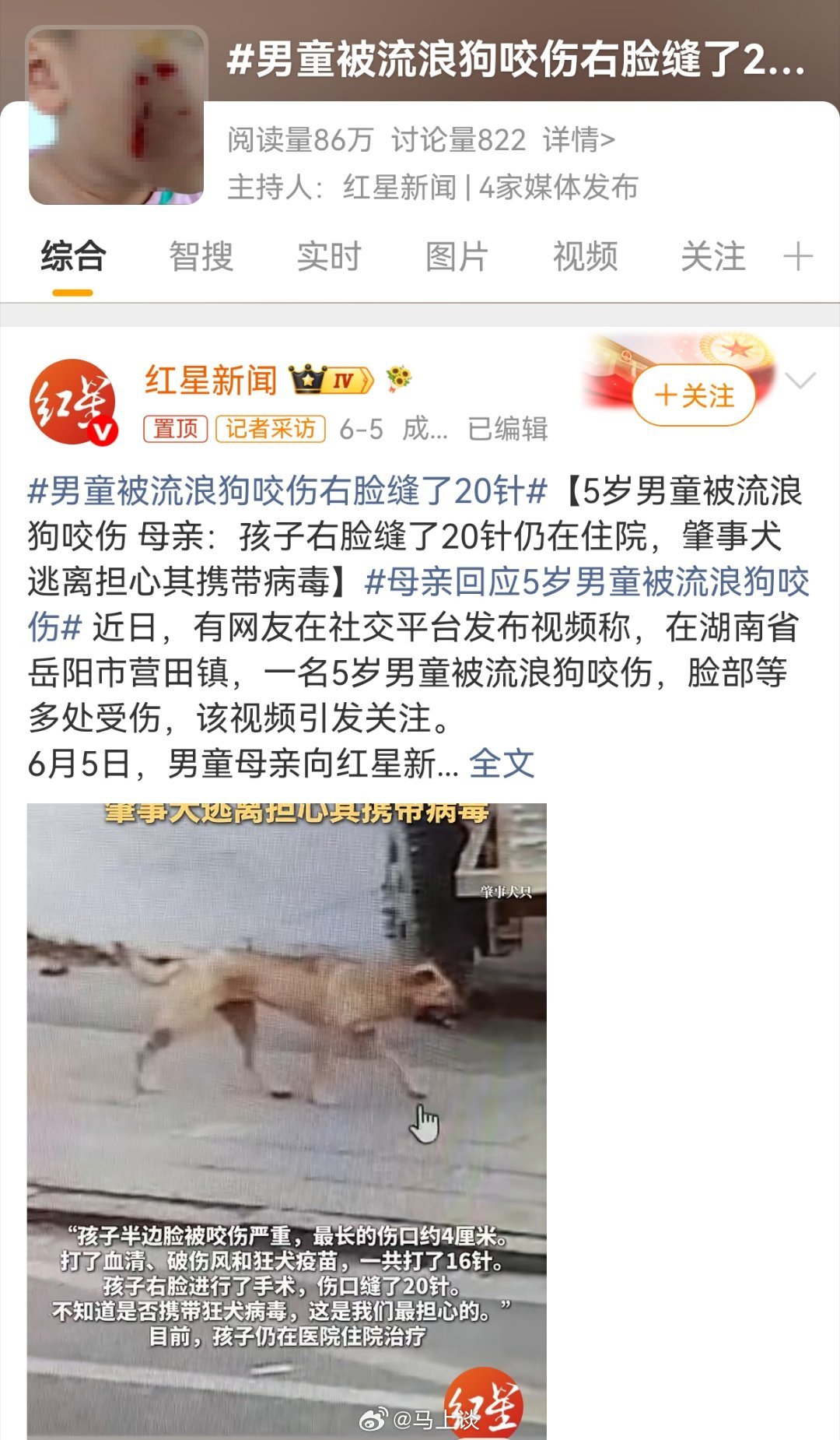 重庆官方通报李某被指虐狗 又去看了下“5岁男童被流浪狗咬伤缝了20针”的新闻，没