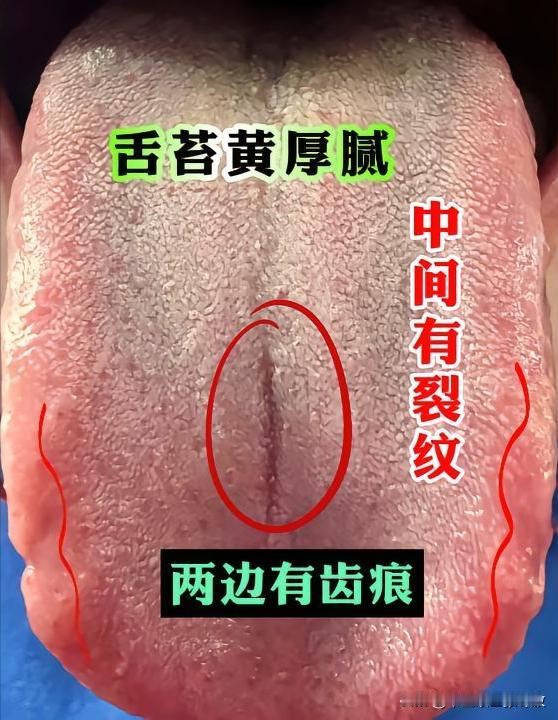 武汉的陈先生，才刚30岁，但是早泄，萎软已经3年了[黑线][黑线][黑线]
主诉