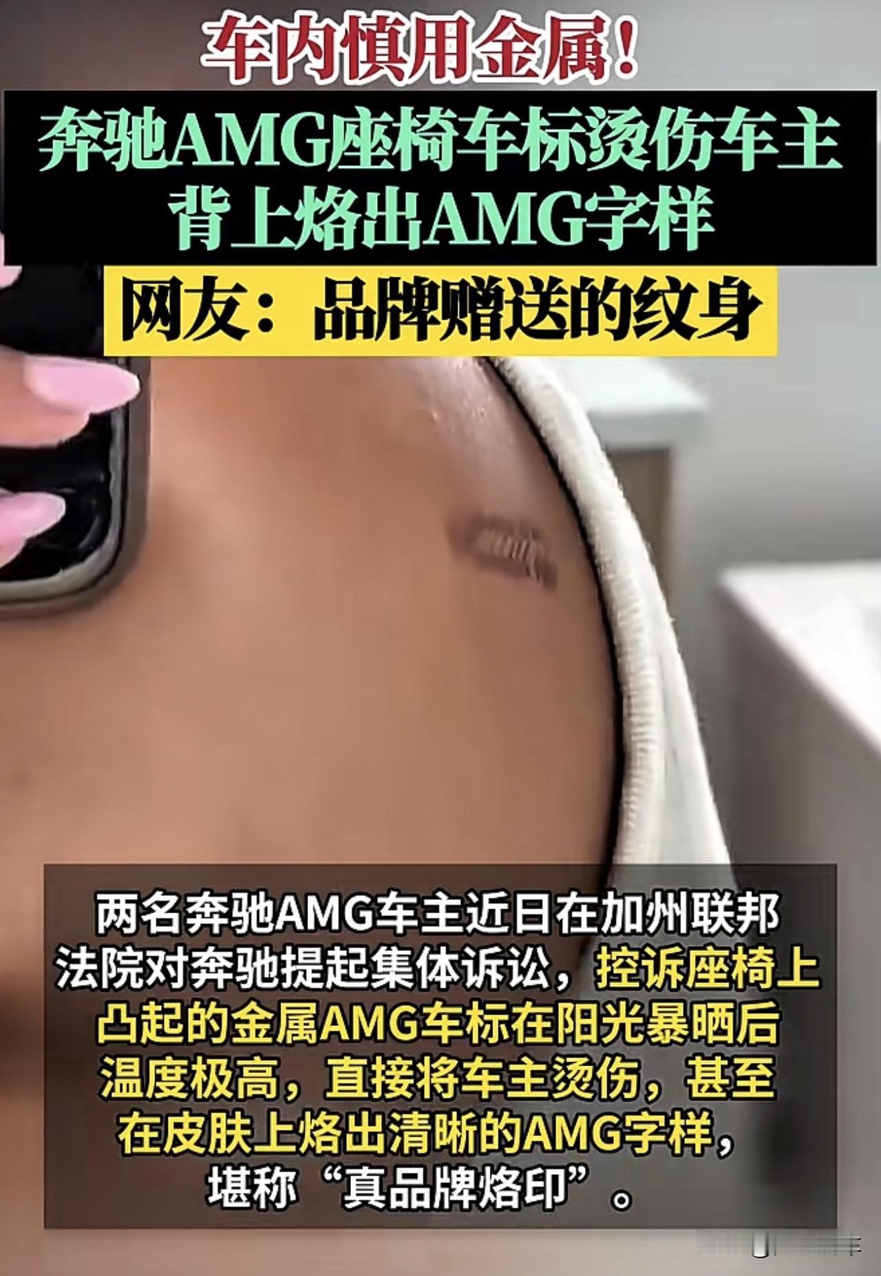 这着实没想到，不过建议没毛病，车企真的不要把金属标弄座椅上，夏天户外的车内你是不