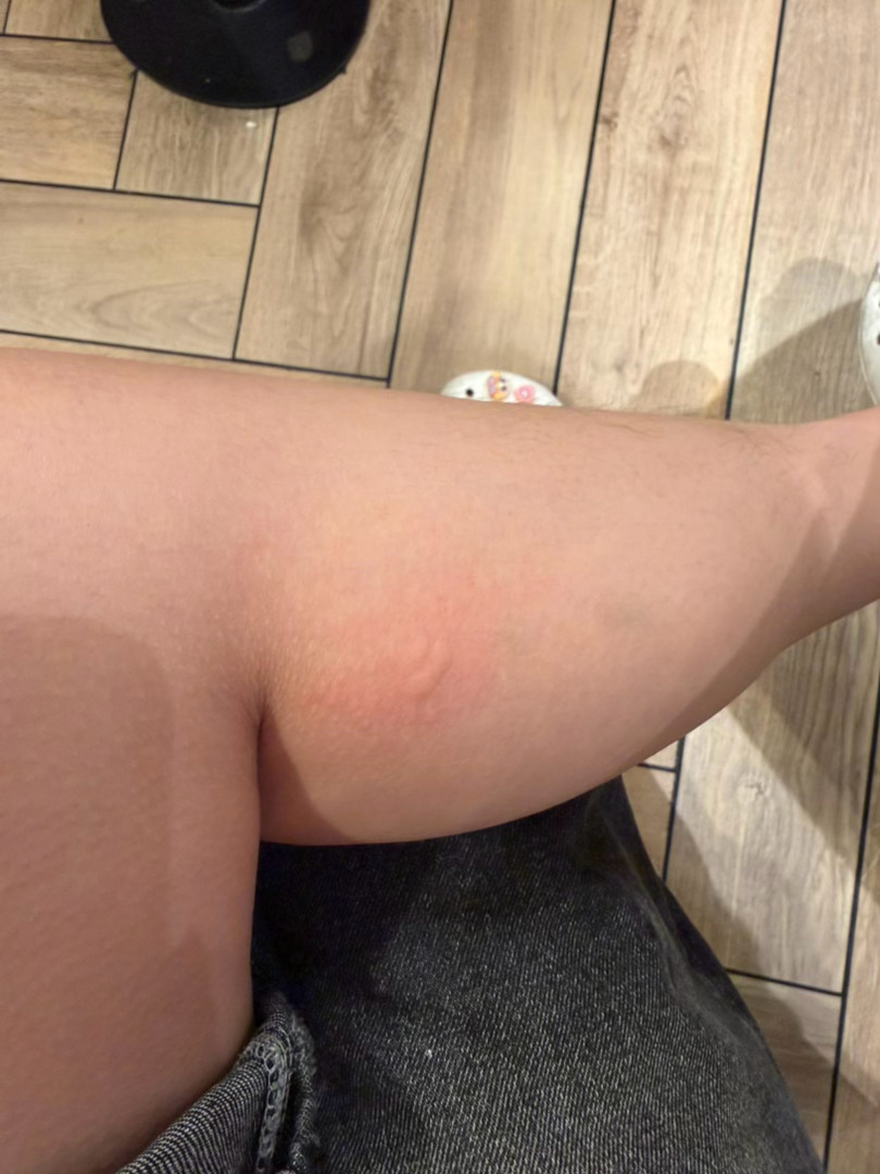 现在吃麦当劳害得献血啊 给我咬3包
