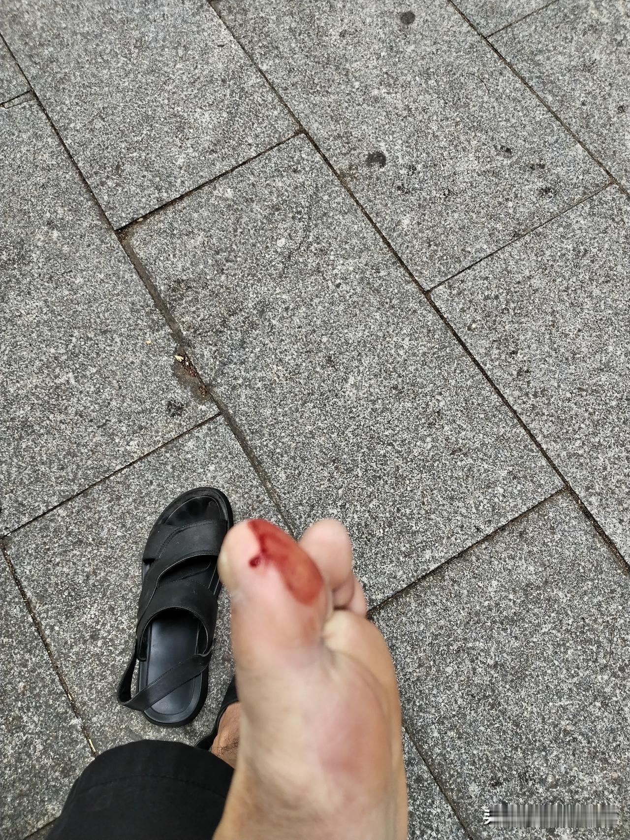 今天傍晚，一场突如其来的不幸降临到我的脚上。
饭后，我出门散步。当我悠然自得地走
