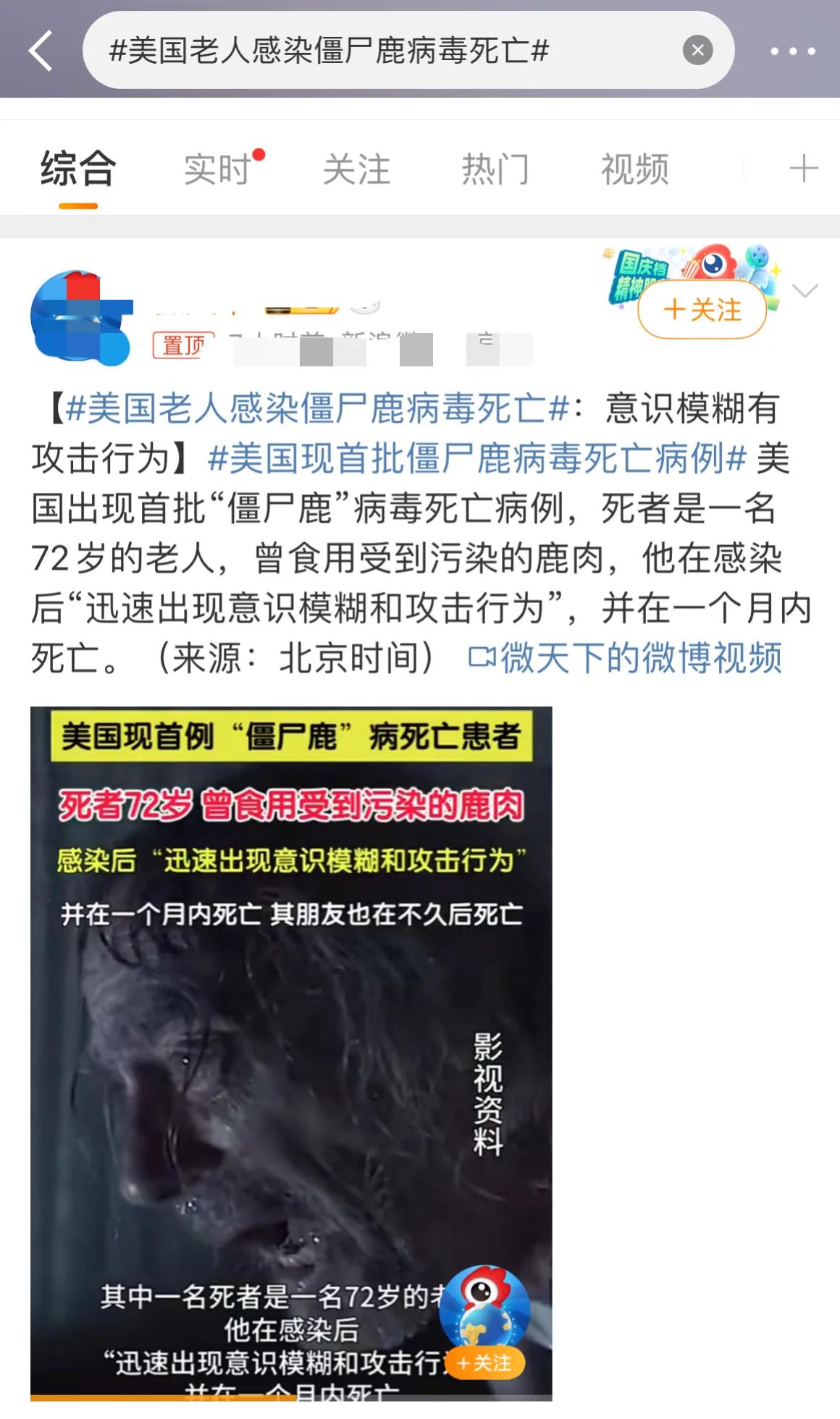 美国老人感染僵尸鹿病毒🦠死亡#美国有多可怕# 是末世在彩排？还是美国政府又在研