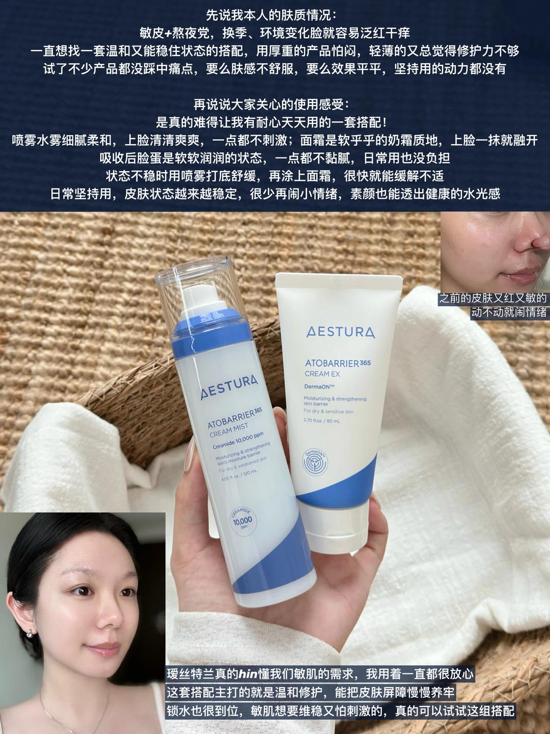 敏肌天菜CP｜轻松养出瓷实肌