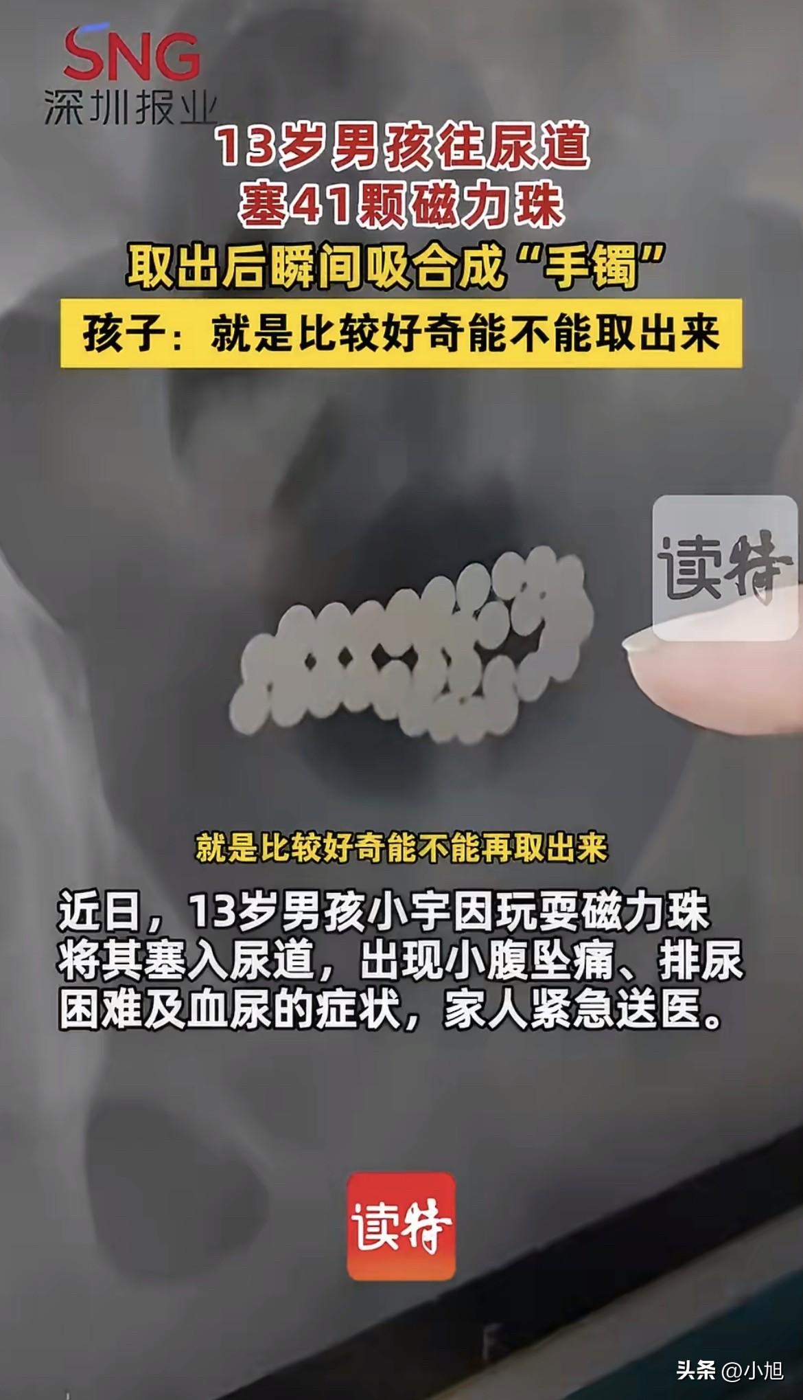 “妈，我疼。”3月25号那天晚上十点多，河南驻马店一个初一男生小宇，站在他妈面前