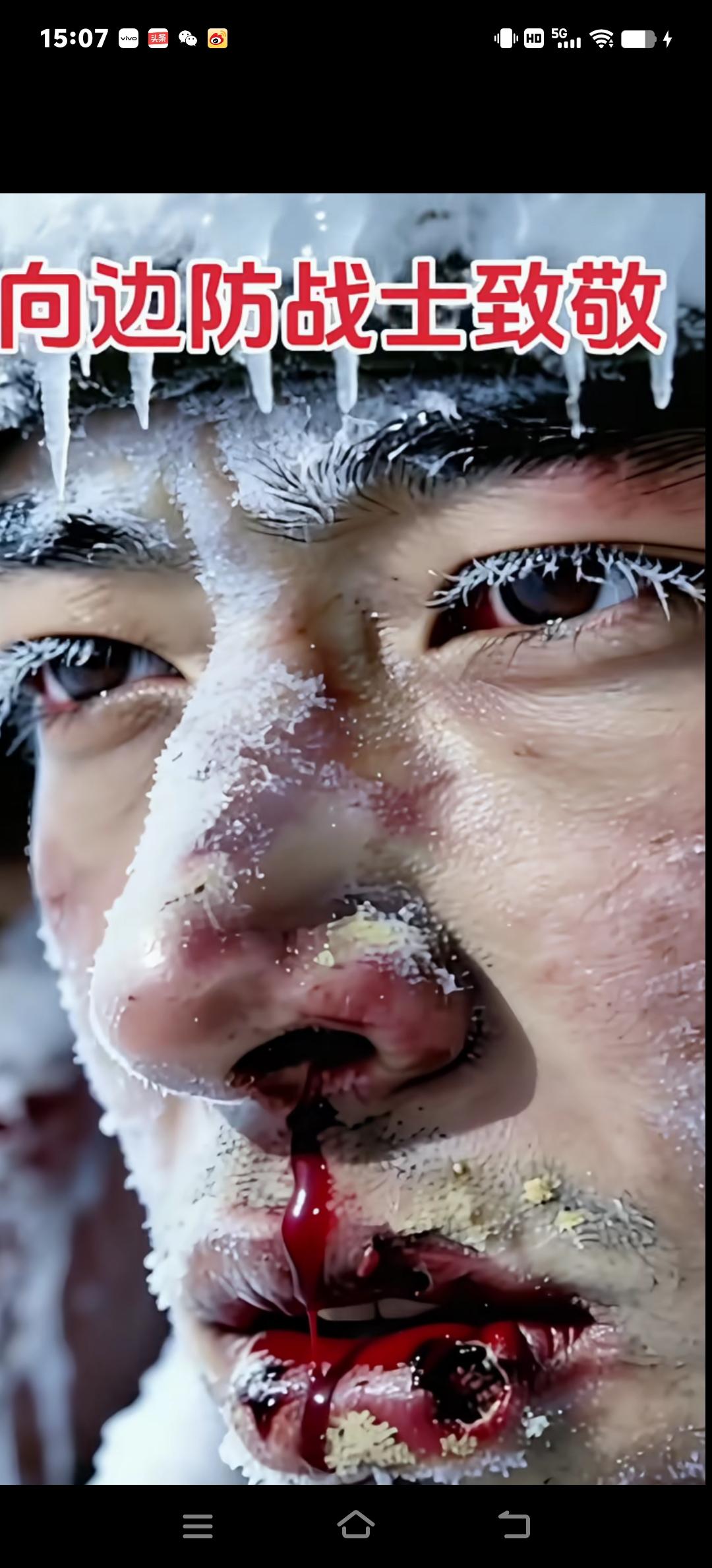 边防战士在那么坚苦的环境下保家卫国家守边防，把脸皮冻裂开鲜血淋漓，鼻血，嘴唇老在