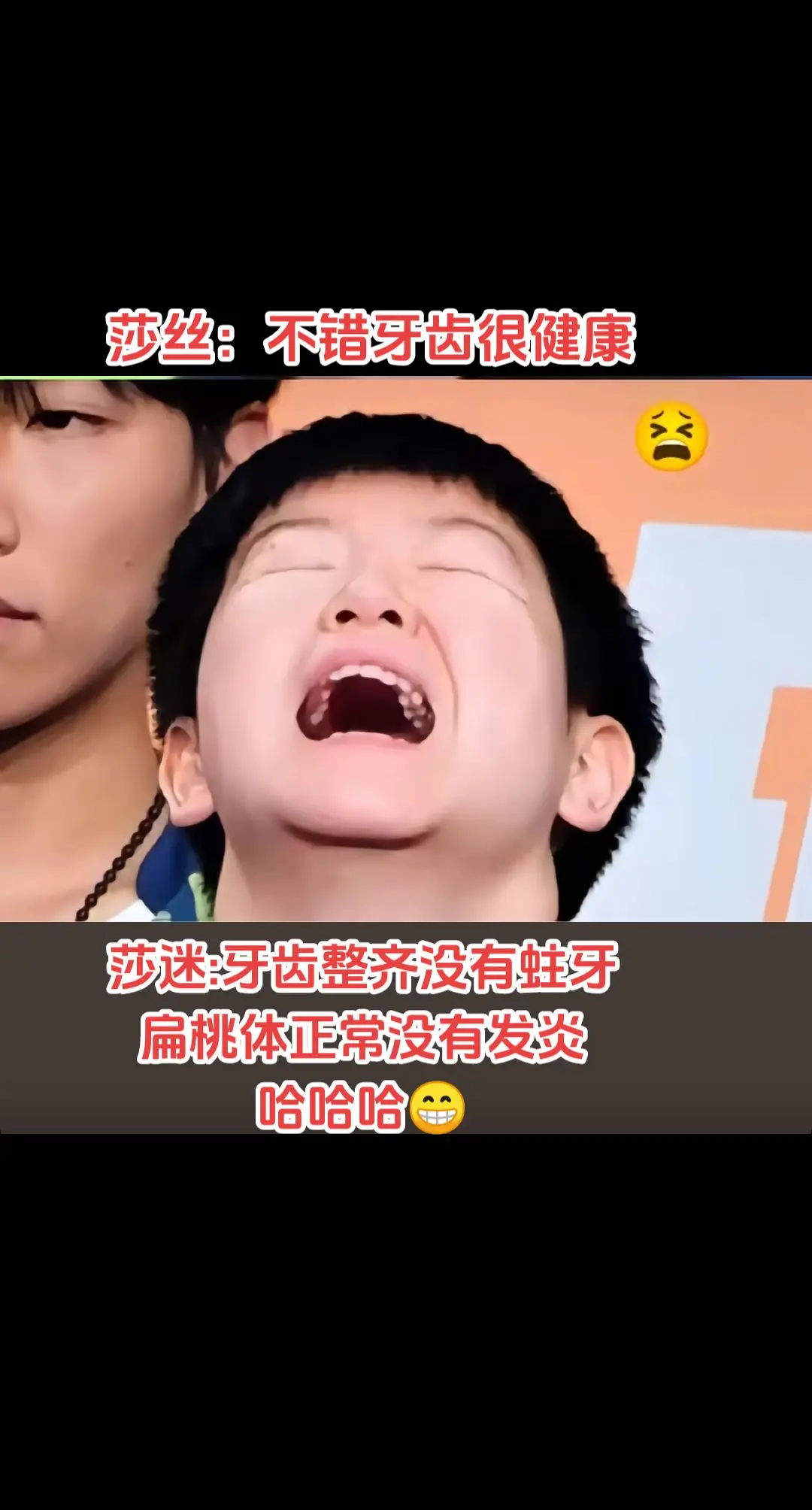 莎迷:莎莎牙齿很健康😂。