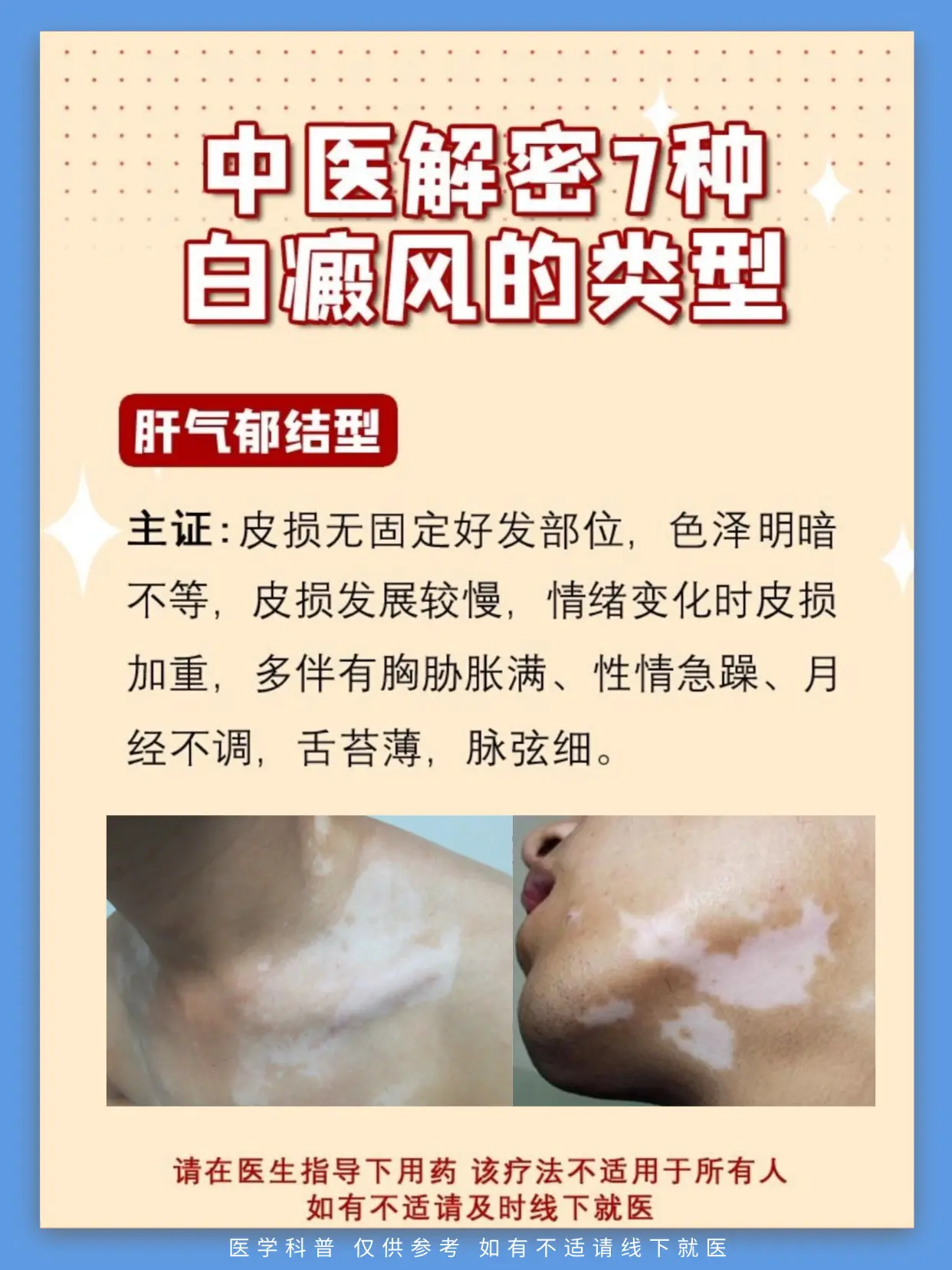 医学科普 白癜风 白癜风科普 白斑 抖出健康知识宝藏