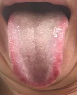 亲密状态时常力不从心，这类体虚表现多和哪些体质因素相关






一位粉丝留言