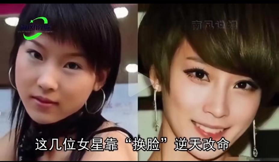 刚出道的谢楠，一张幼态脸，婴儿肥，满脸的胶原蛋白，现在的谢楠，太瘦了，下巴很尖，