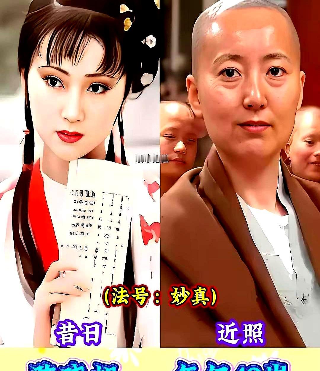 41岁亿万富姐剃光头
 

演林黛玉的陈晓旭，癌症扩散全身，拒绝化疗。
 

2