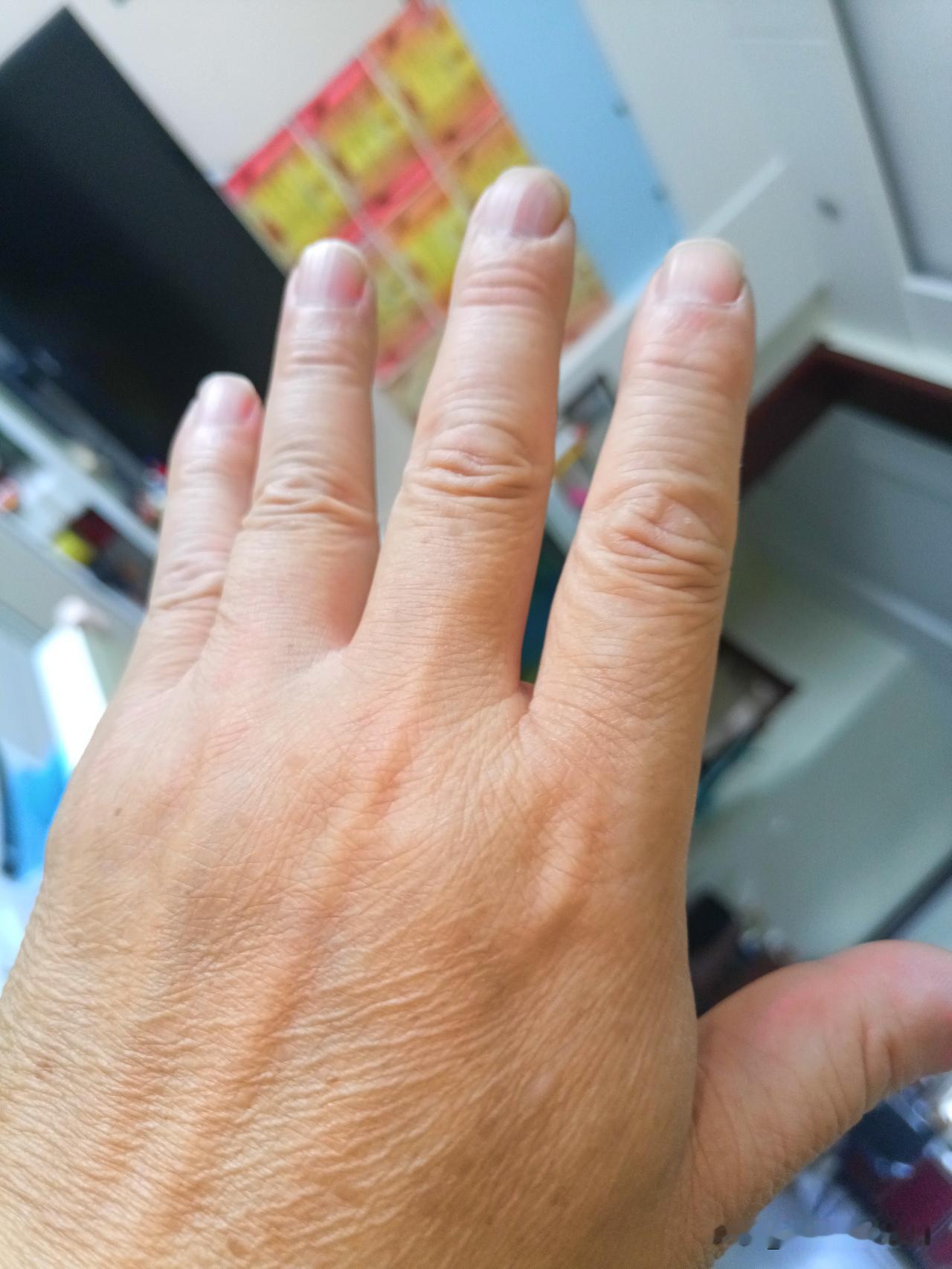 一个老板做生意经常赔钱，这时有人对他说：你手指缝间隙宽，漏财。
怎么办呢？又有人
