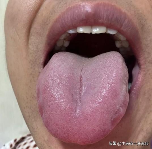 中年男人的两大标配：肝郁和脾虚，别老盯着肾虚不放啦。

患者主诉：身体不如以前了