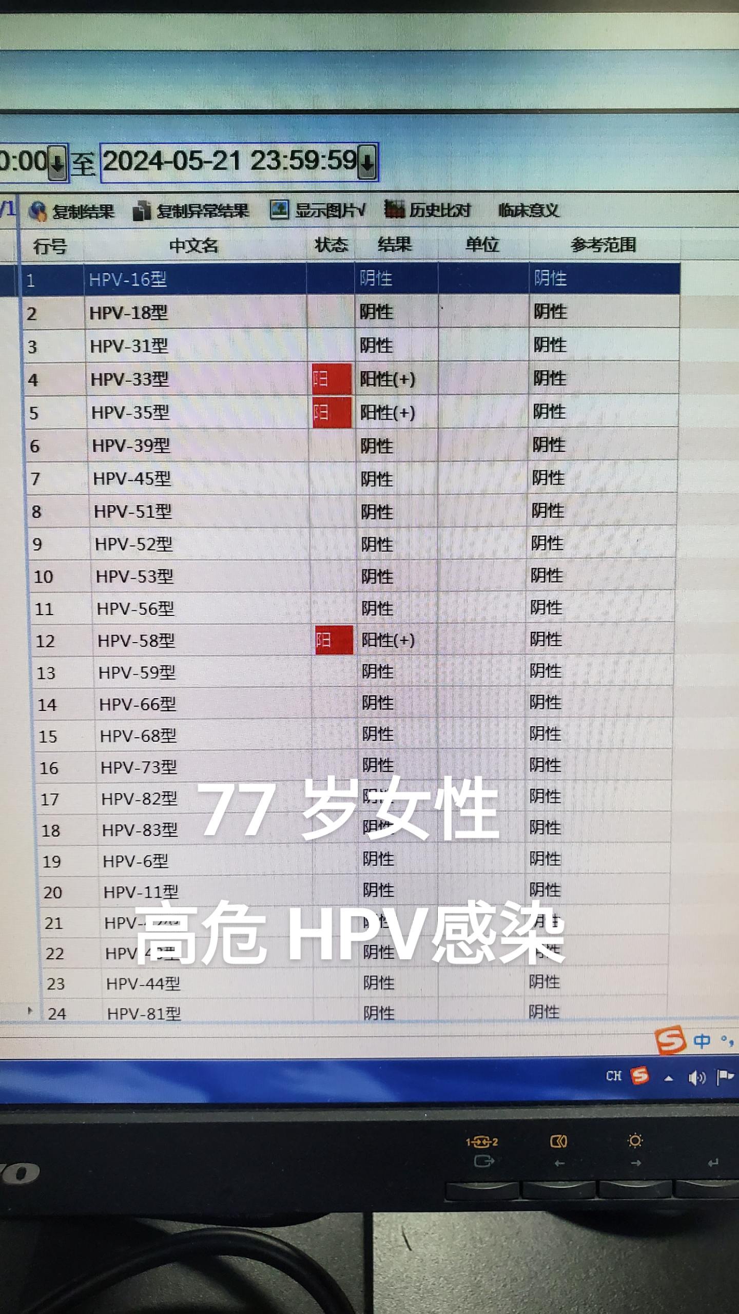hpv感染