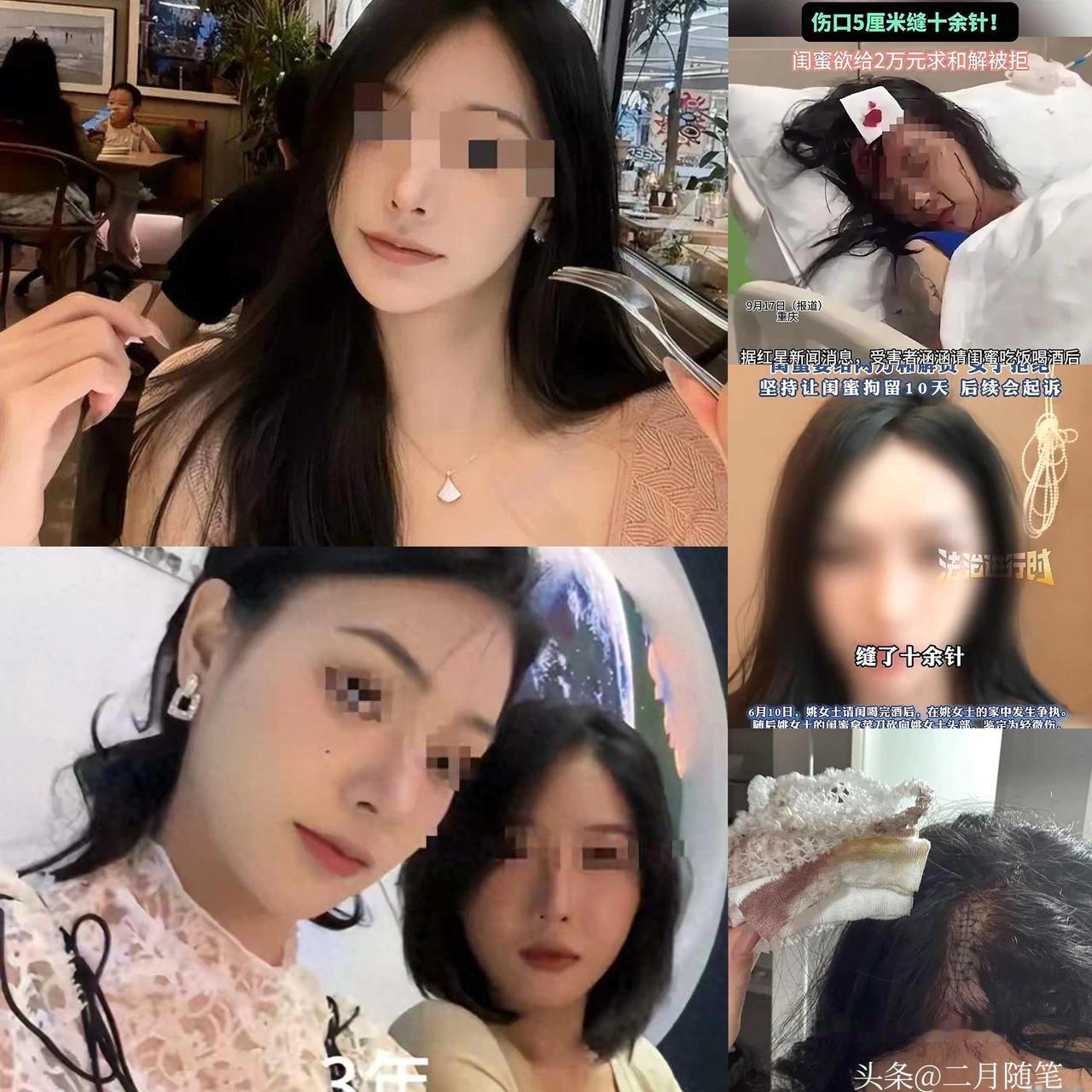 拒绝和解，
被砍女子发声，
要让闺蜜为自己的行为付出代价！

闺蜜请客变血案！