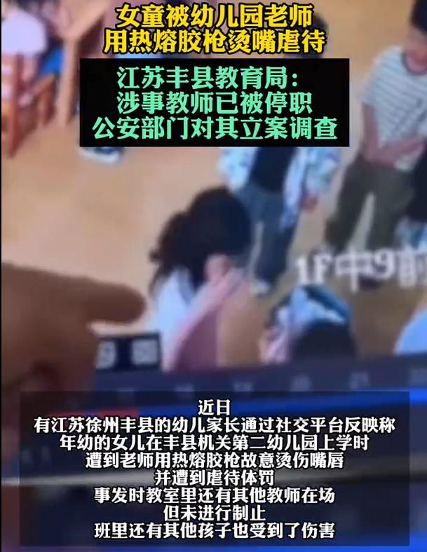 女童被幼儿园老师用热熔胶烫嘴虐待，通过视频可以清晰地看到该幼师用热熔胶烫孩子的嘴