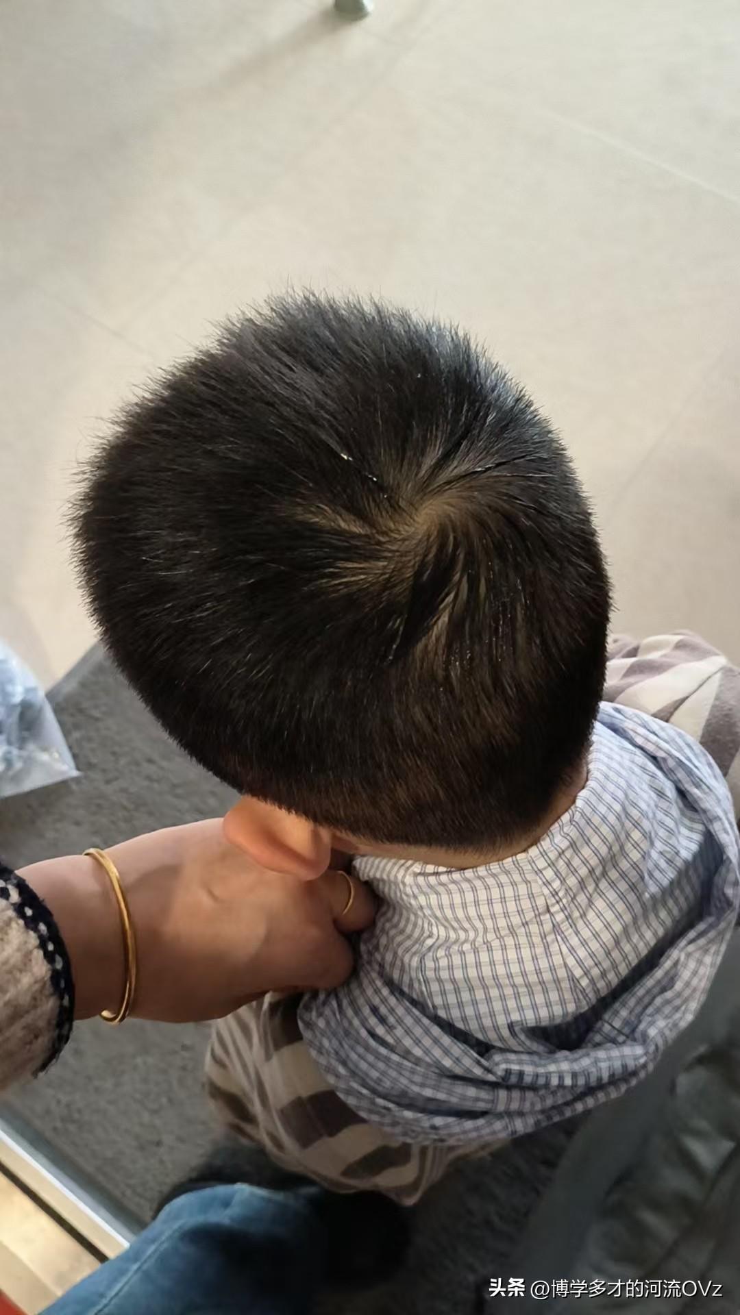 今天是金碧物业走后的第207天，大年无业的第115天。

今天网格员受到了直接的