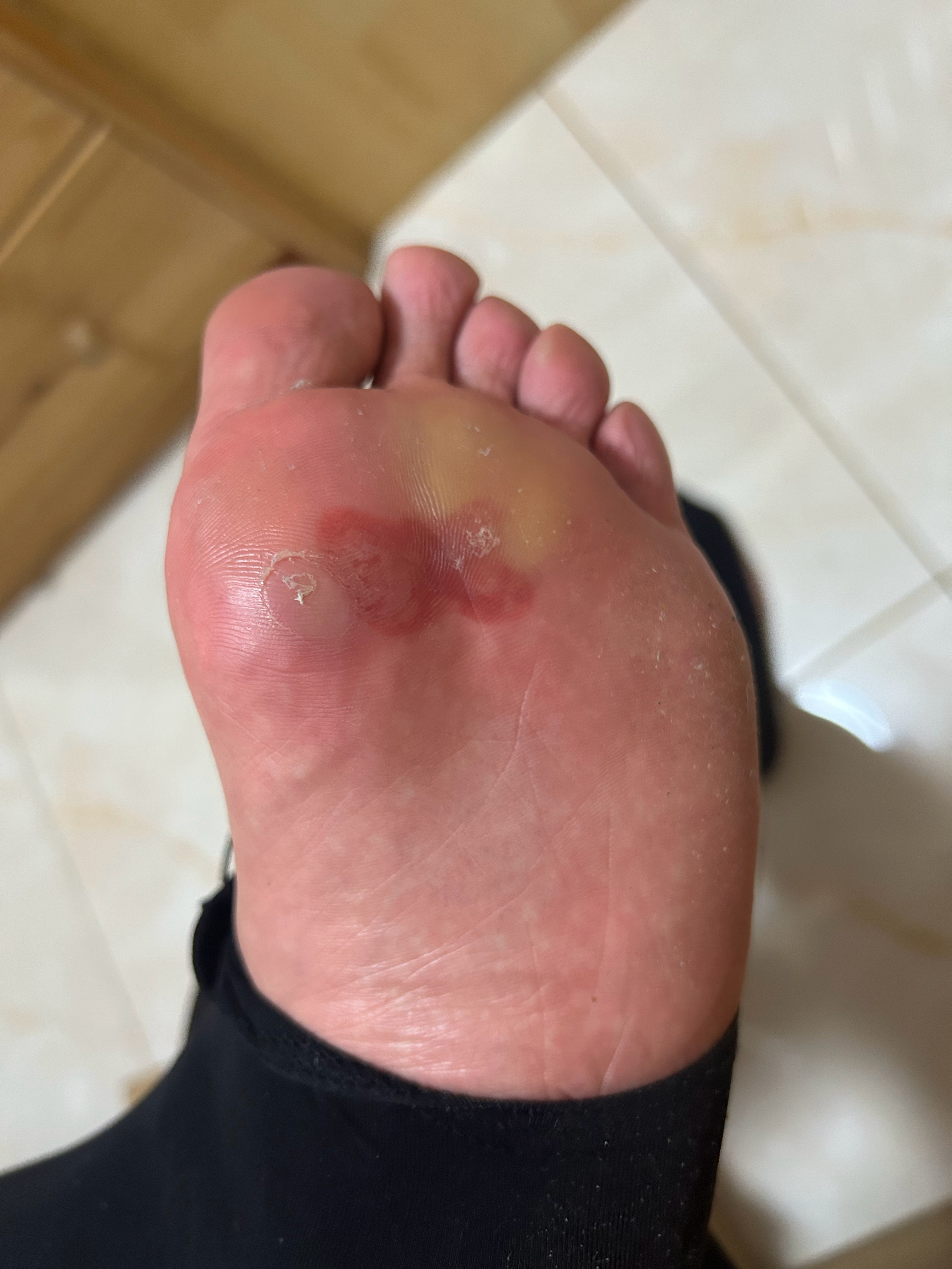 我说：没有我你可怎么办啊。我跟人结婚了你可怎么办啊。要跟我结婚那人说：😬我在呢