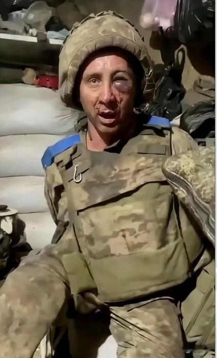 煮豆燃豆萁，豆在釜中悲泣。本是同根生，相煎何太急？俄罗斯和乌克兰同为斯拉夫民族，