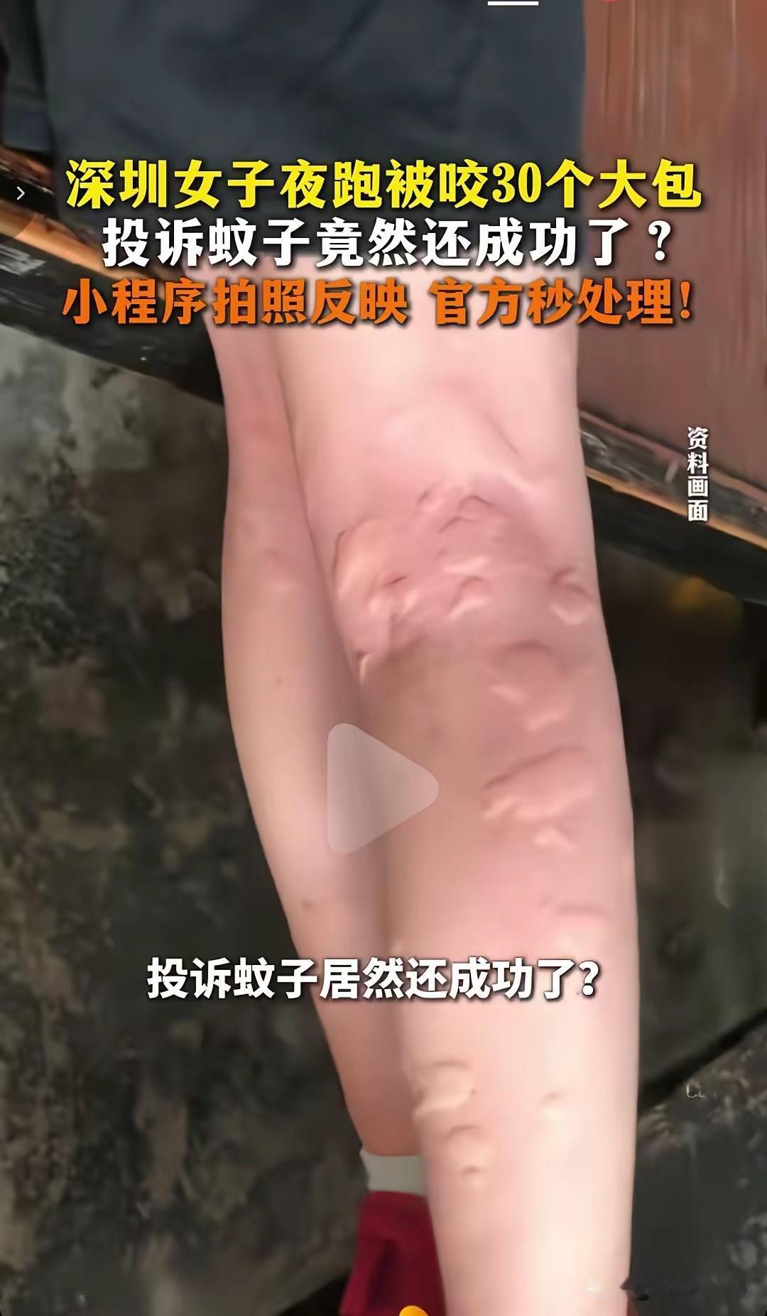 深圳一女子夜跑时被蚊子叮了30个包，气不过在官方小程序投诉蚊子，没想到投诉当晚就