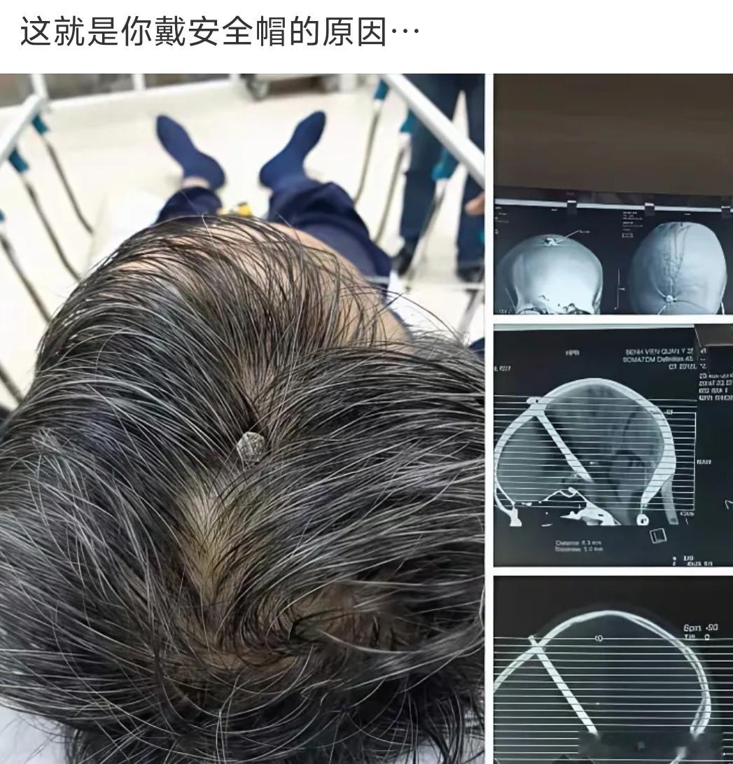这就是让你戴安全帽的原因。 ​​​