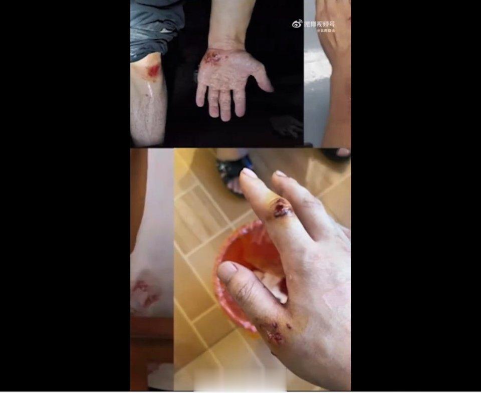 #缉毒警说不想再因缉毒而立功#受到表彰虽然是一件很骄傲的事情，但他们并不希望因为