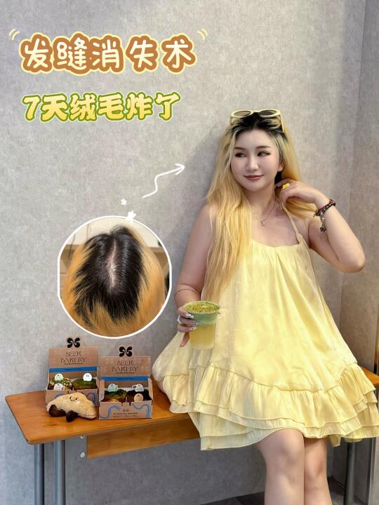🇲🇴实名打卡!!!秃头女孩被这黑科技救活了