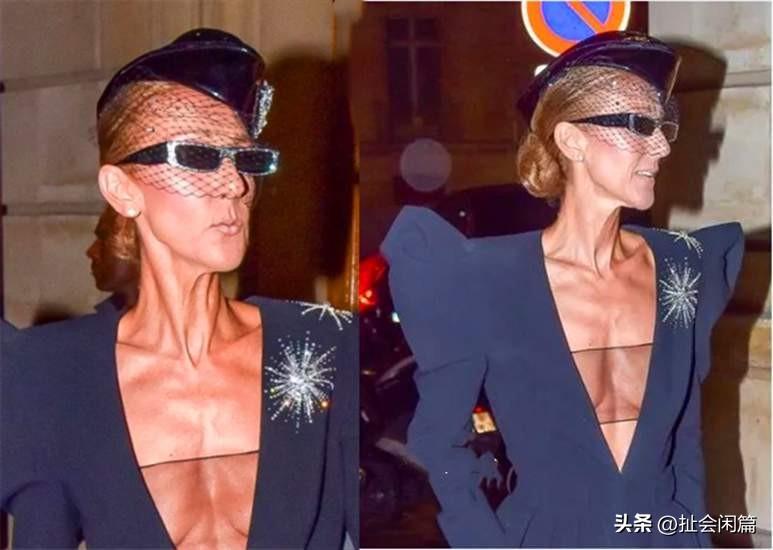 好消息，天后席琳迪翁又回来了！

因为饱受僵人综合症的困扰，著名歌星席琳迪翁，身