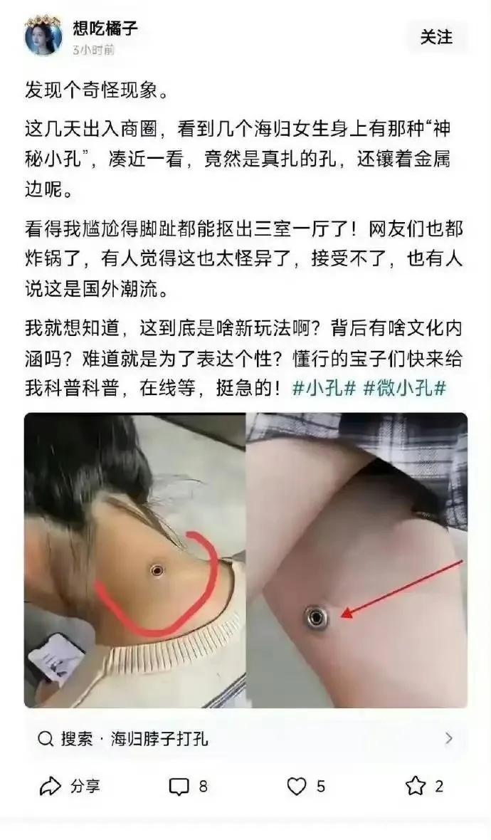 这肯定是为今后生病输液方便吧？