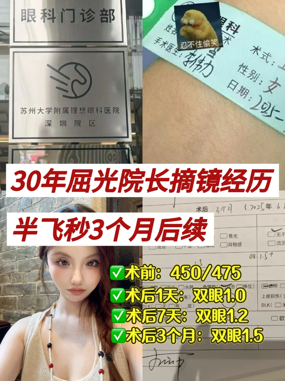 深圳近视眼手术，公立👨‍⚕半飞3个月后续