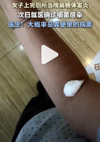 女子公司如厕感染粪便病菌无法吞咽  上个厕所差点把命搭上，这届打工人太难了。上海