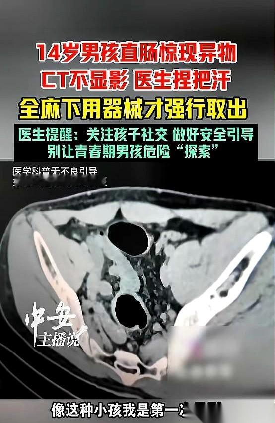 广东深圳，一个14岁的男孩站在急诊室里，脸色惨白，汗珠子顺着鬓角往下淌。他低着头