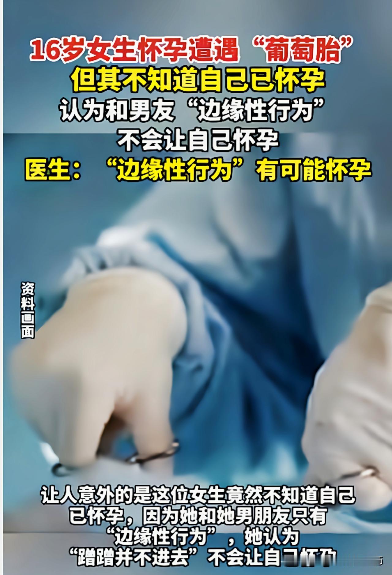 真是糊涂啊。广东一名16岁女生近日确诊葡萄胎，让人意外的是这个女生并不知道自己早