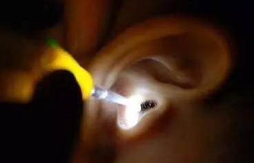 蚊虫入耳别慌张，告诉你正确做法！
凌晨三点，大多数人都在梦乡，但耳鼻喉科的急诊室