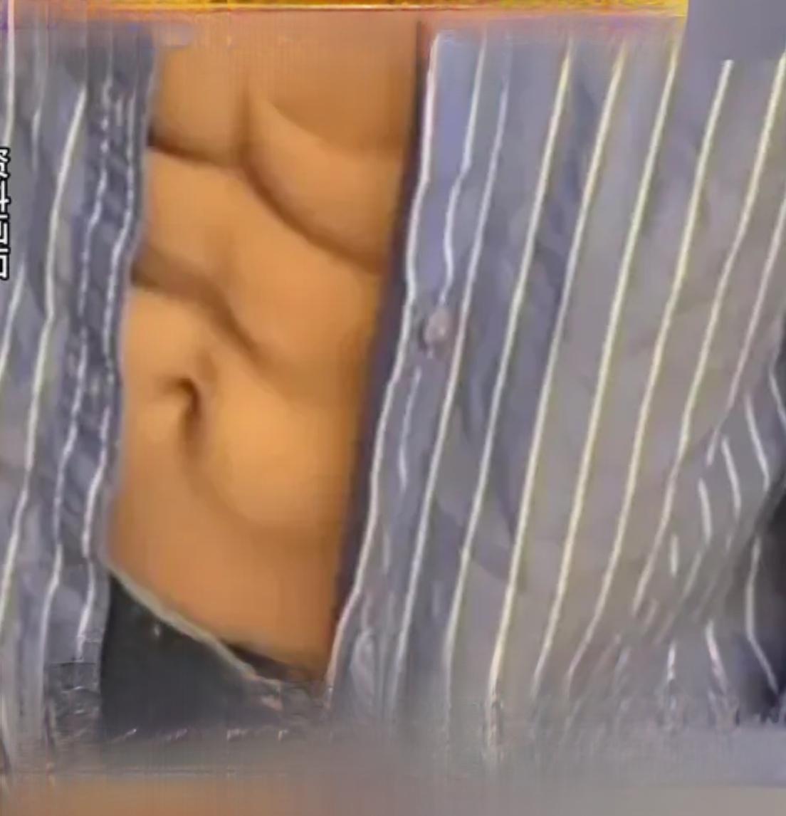 花7万打83针玻尿酸，不健身速成腹肌，这波操作真的值吗？

最近刷到一条新闻，有