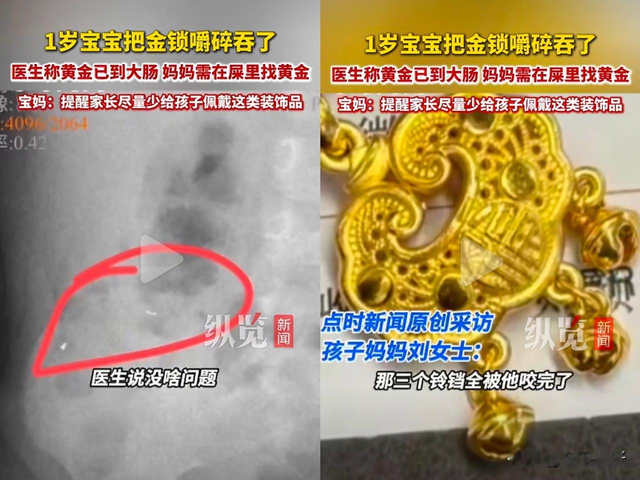 2026年1月24日凌晨，贵阳刘女士在关灯哄睡时，听到1岁5个月的儿子口中传来咀