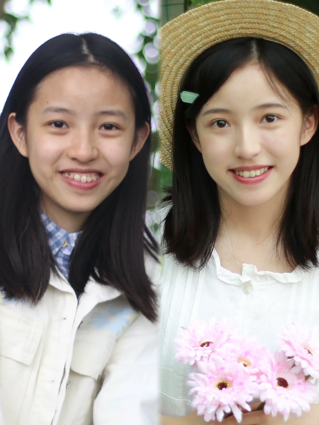 正畸前与正畸后 两副面孔