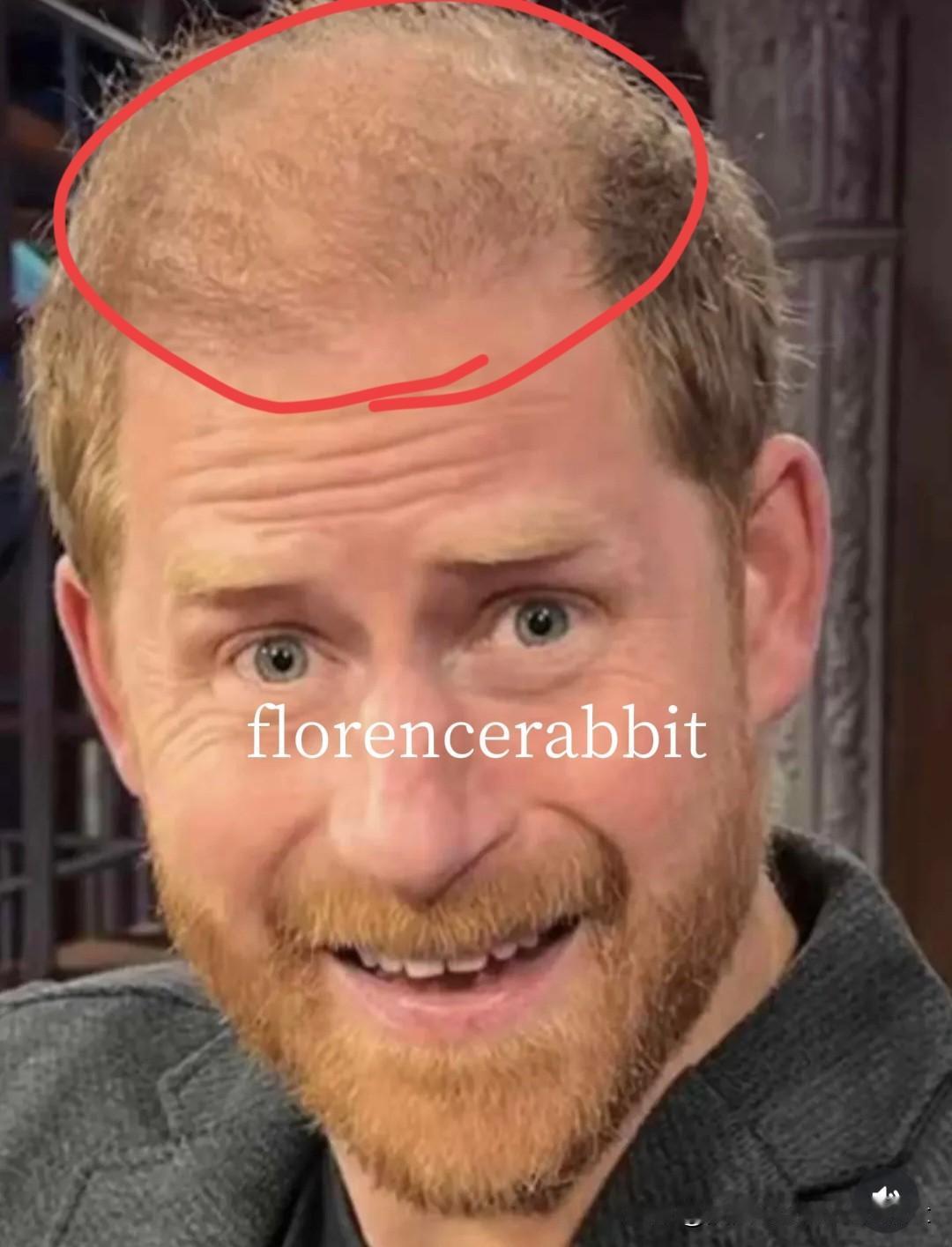 哈哈哈！科尔伯特让H 彻底出丑了！这位自称是“英俊的王子”，对着全美镜头嘲讽美国